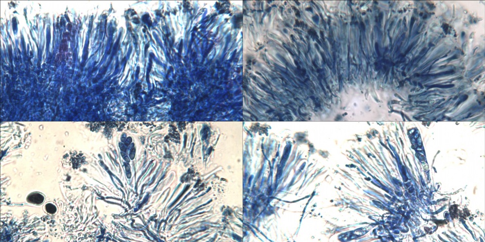 Lecania spadicea image