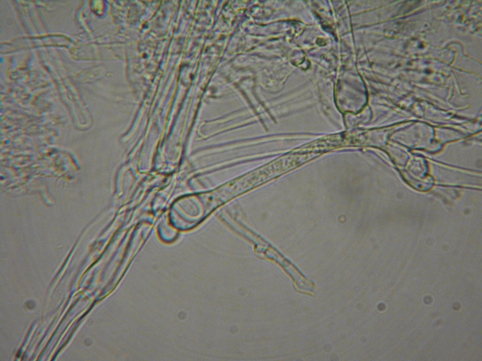 Sistotrema brinkmannii image