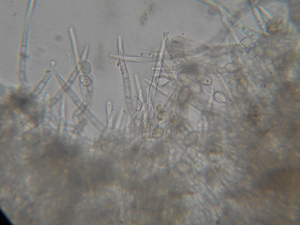 Botryobasidium obtusisporum image