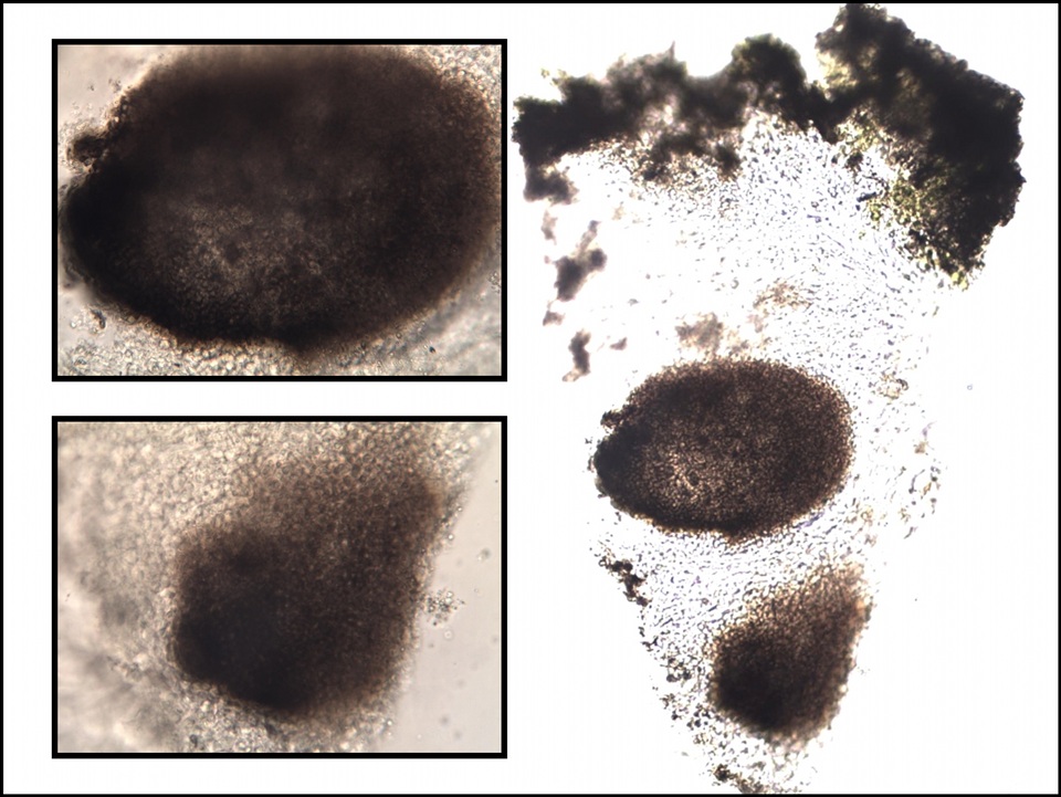 Dactylospora parellaria image