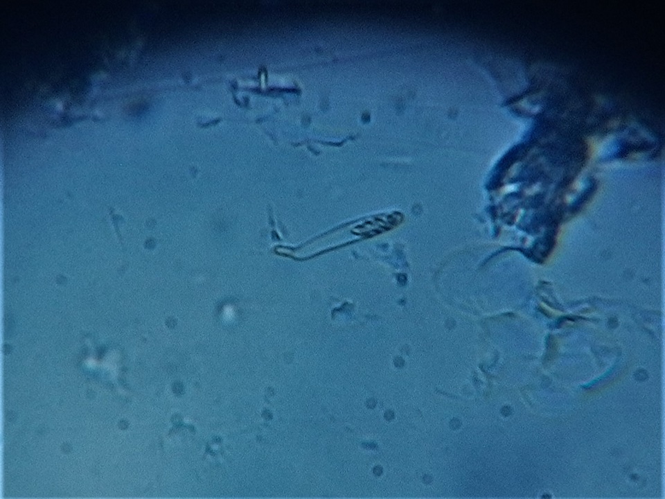Dematioscypha dematiicola image