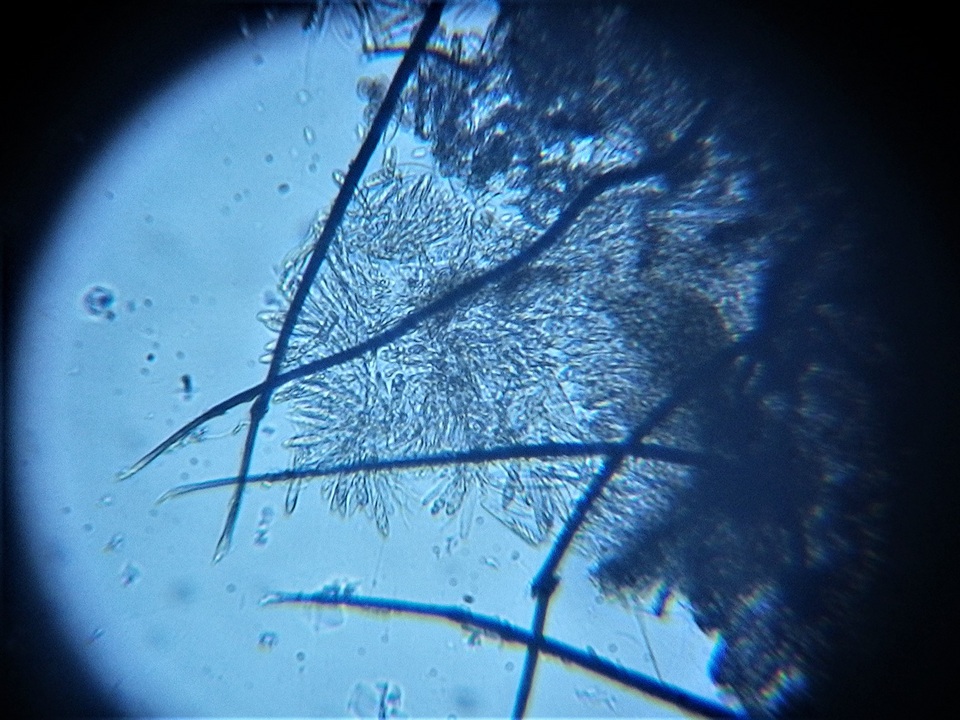Dematioscypha dematiicola image