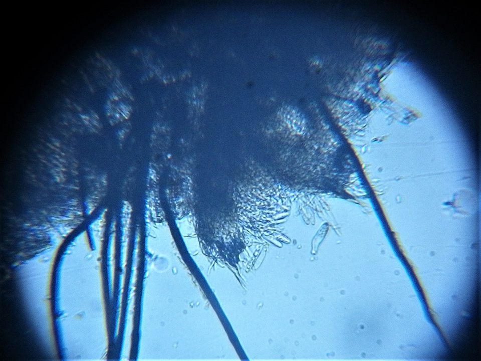Dematioscypha dematiicola image