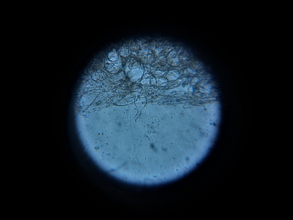 Pachyella celtica image