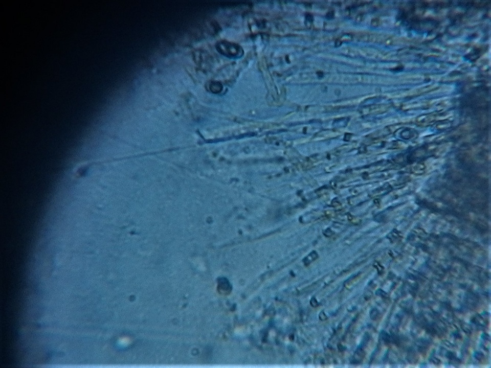 Pachyella celtica image
