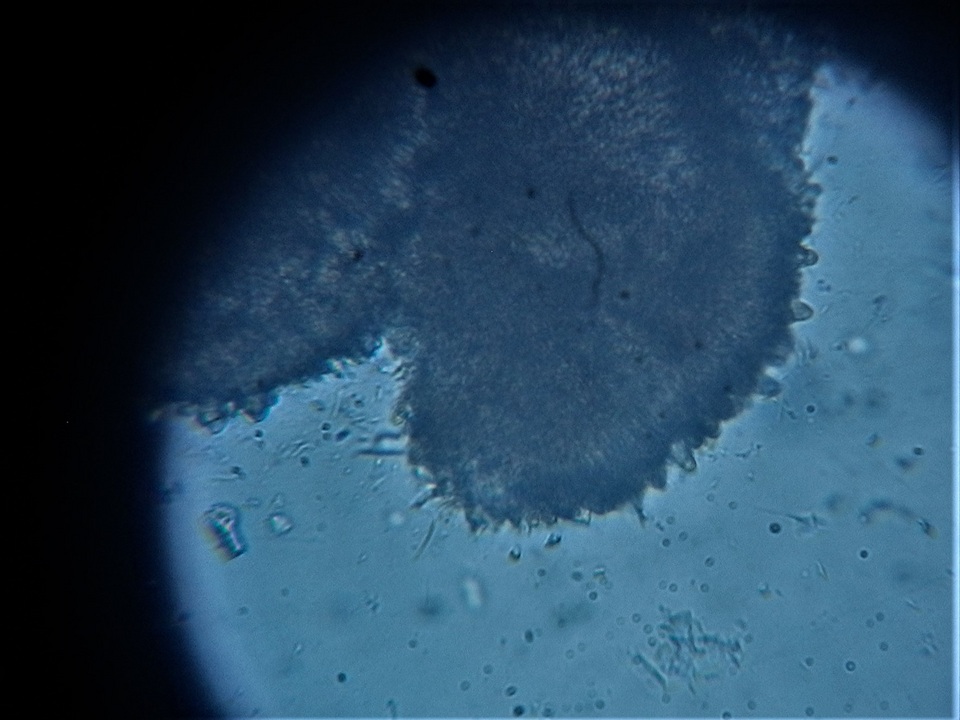 Vezdaea leprosa image
