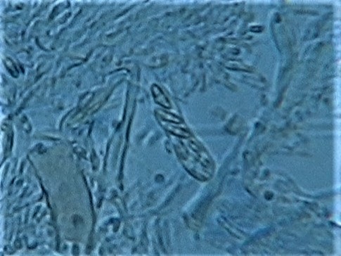 Vezdaea leprosa image