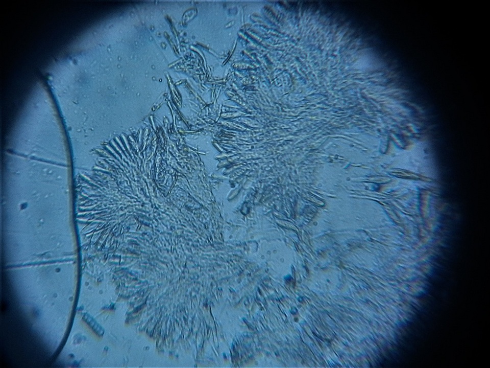 Vezdaea leprosa image