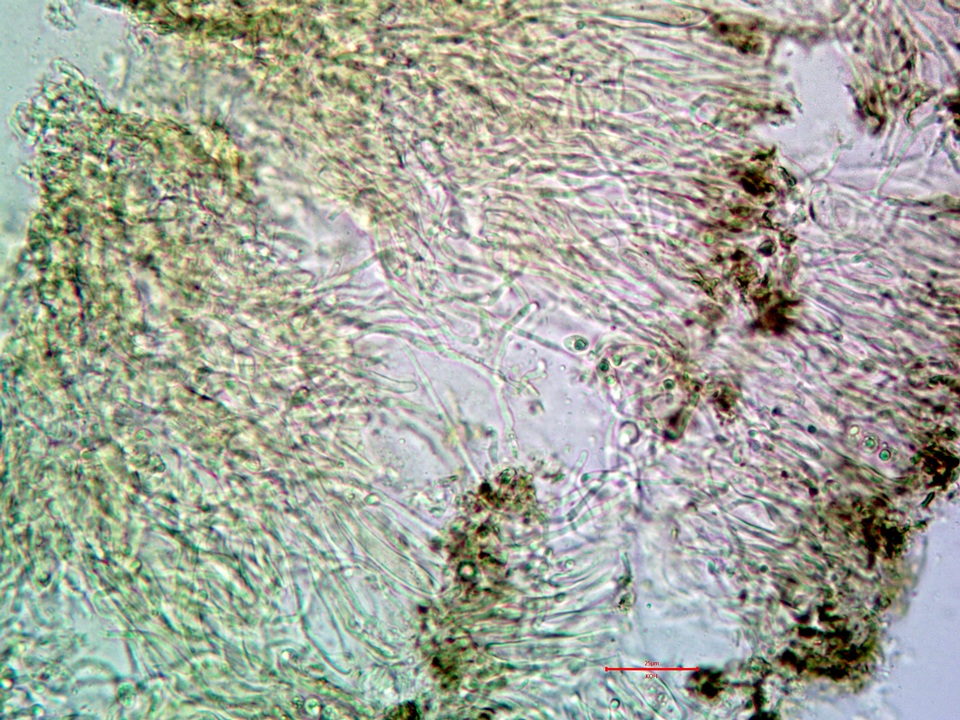 Trapeliopsis glaucopholis image