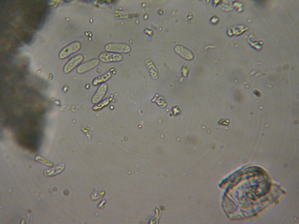 Hyphoderma setigerum image