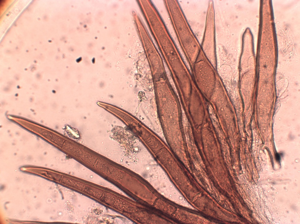 Scutellinia nigrohirtula image