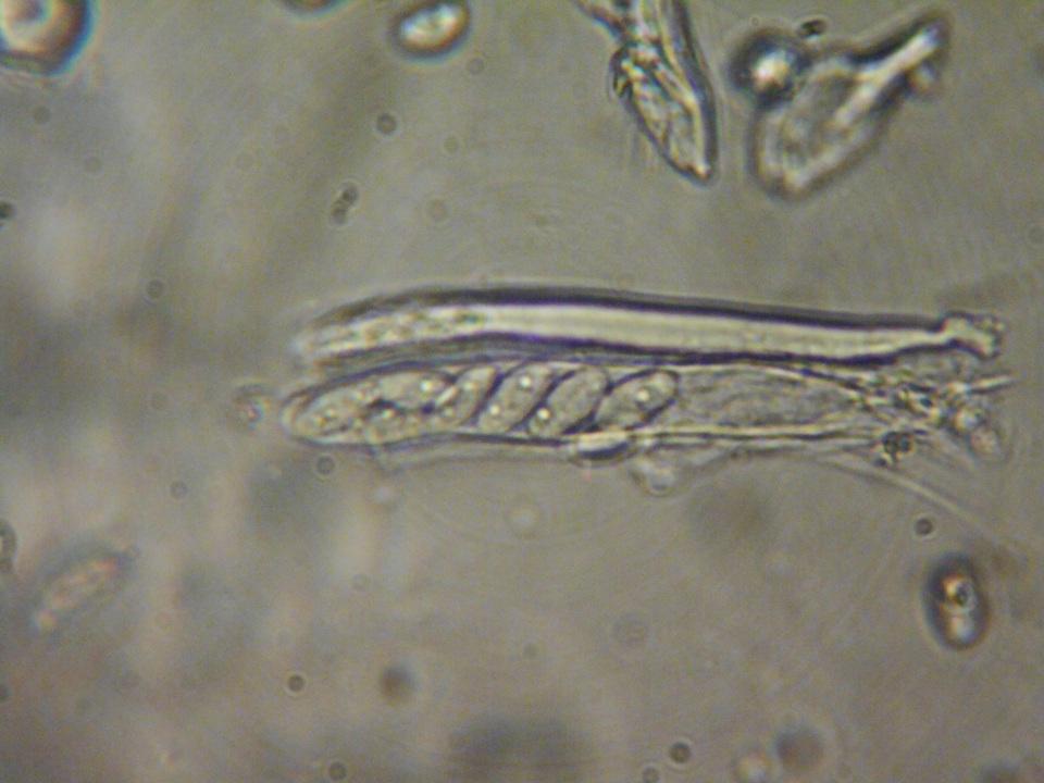 Pezoloma ciliifera image