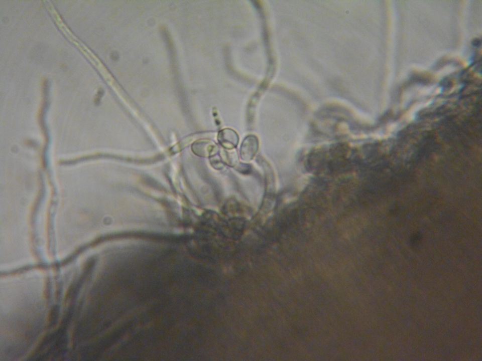 Pezoloma ciliifera image
