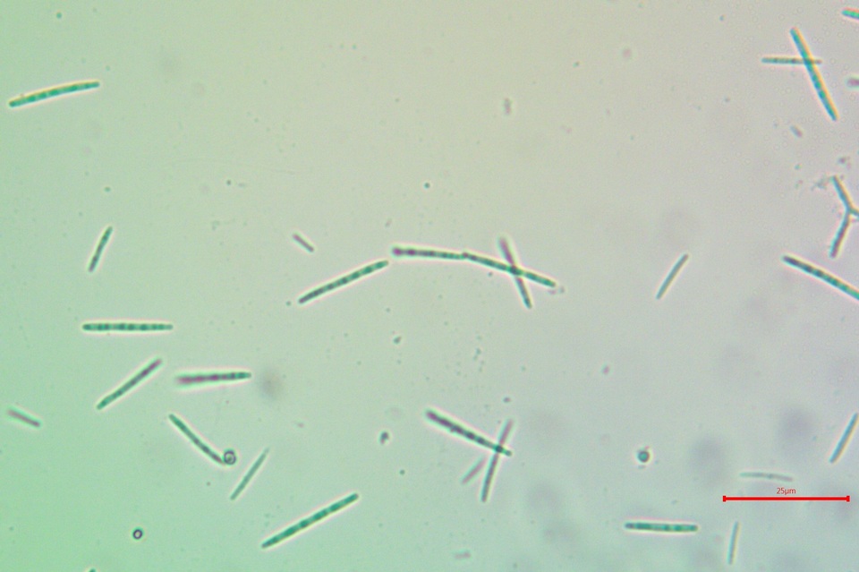 Alyxoria ochrocheila image