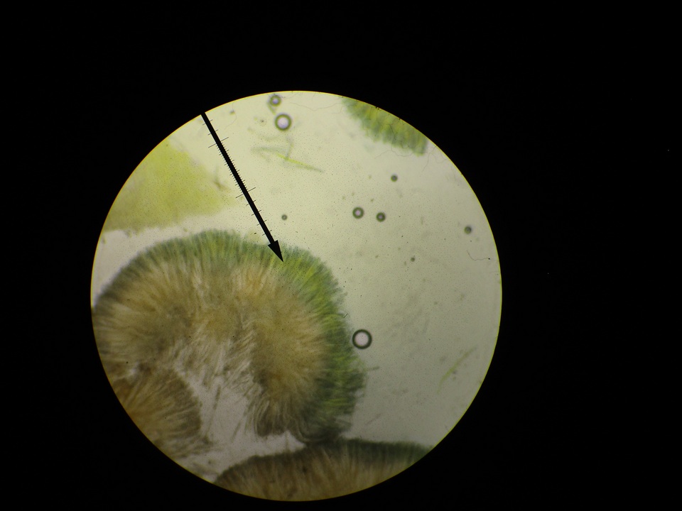 Peziza saccardiana image