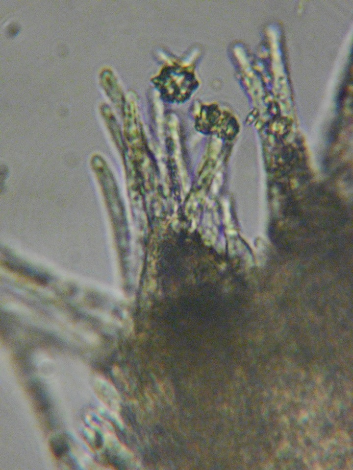 Peziza echinulata image
