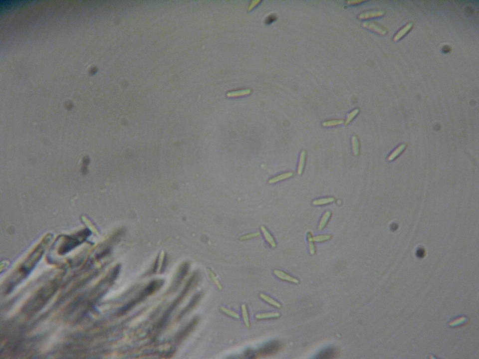 Peziza echinulata image