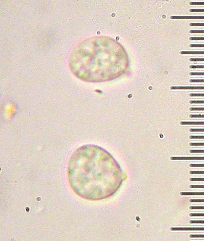 Hydnum aerostatisporum image