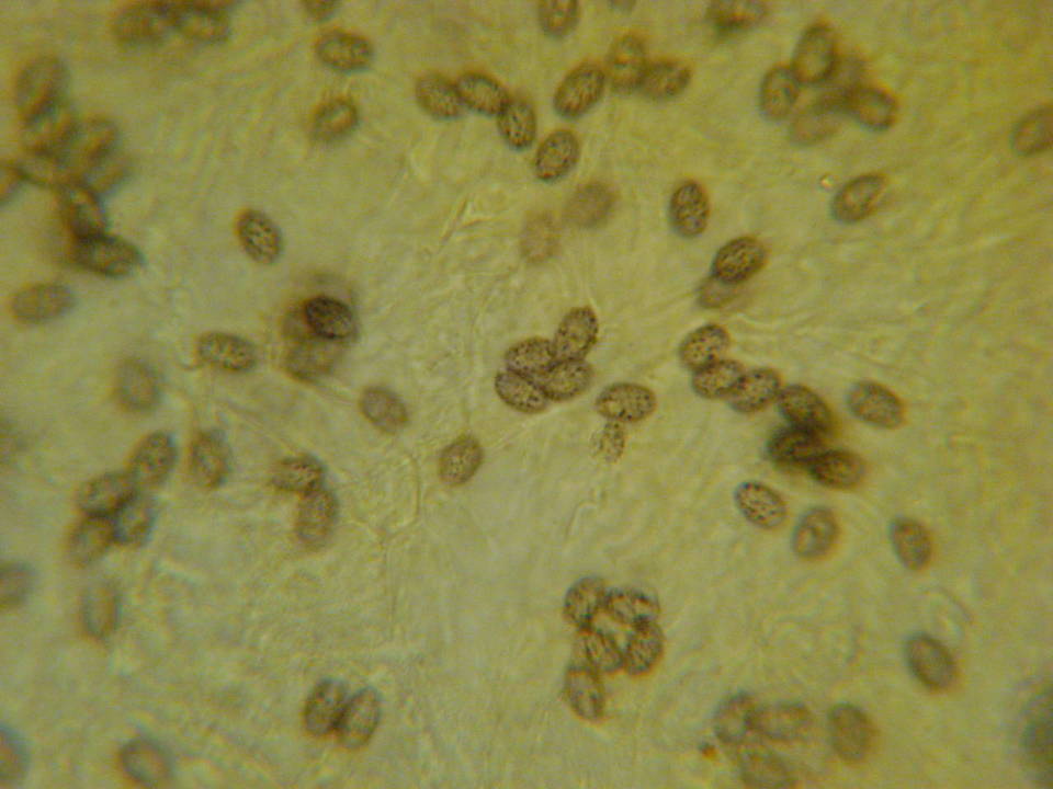Melanoleuca lewisii image