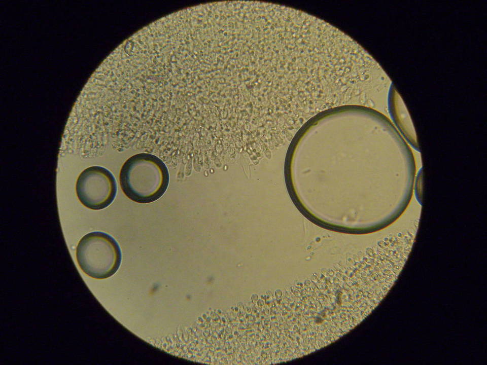 Melanoleuca lewisii image