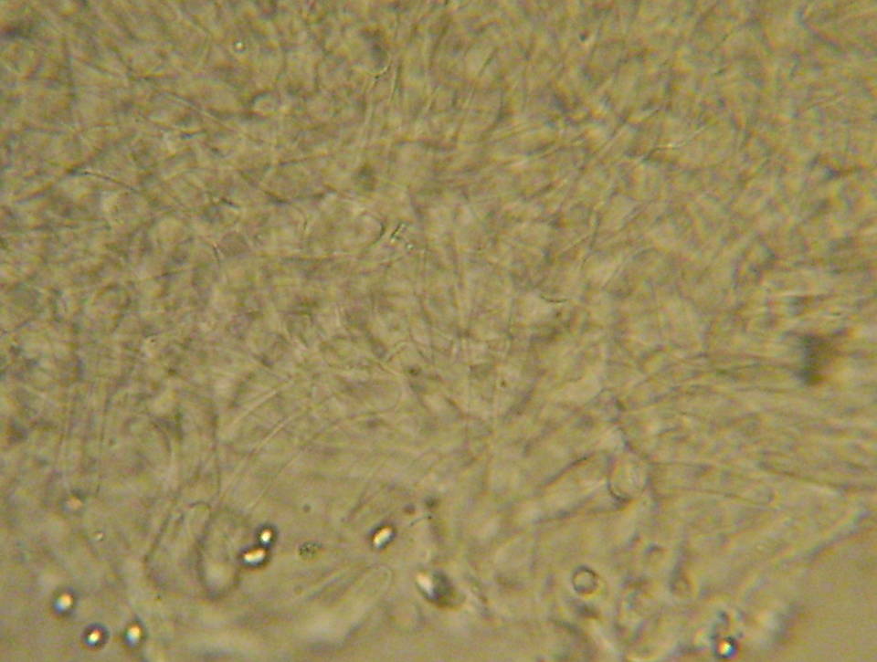 Melanoleuca lewisii image