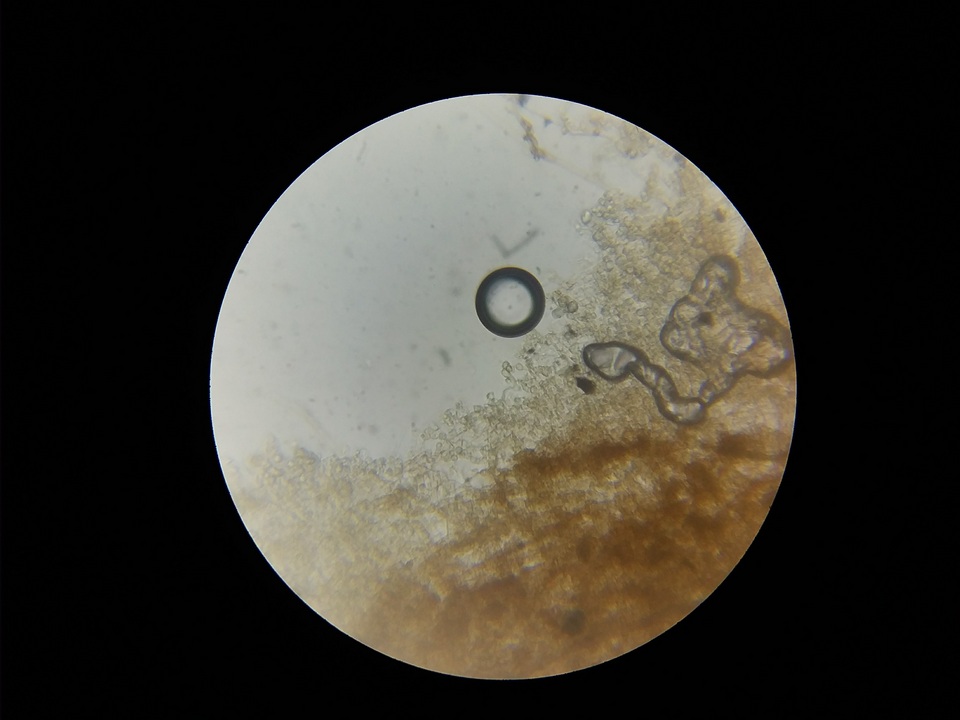 Phlebiella christiansenii image