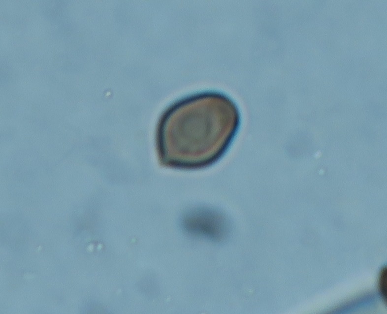 Coprinellus saccharinus image