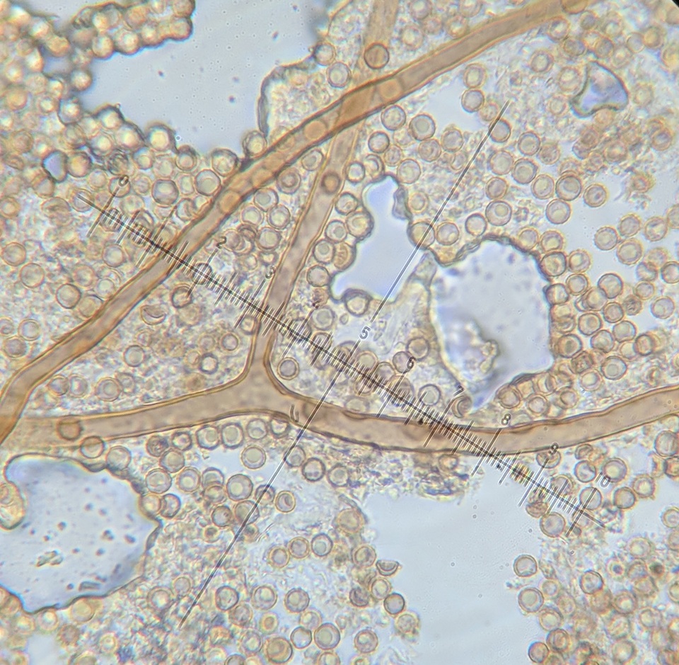 Lycoperdon mammiforme image