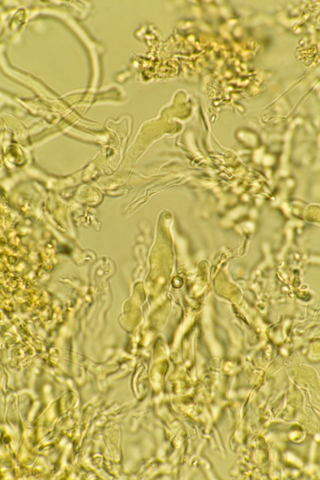 Corticium lombardiae image