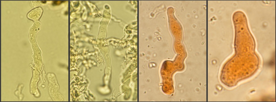 Corticium lombardiae image