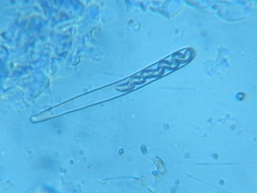 Rutstroemia sydowiana image