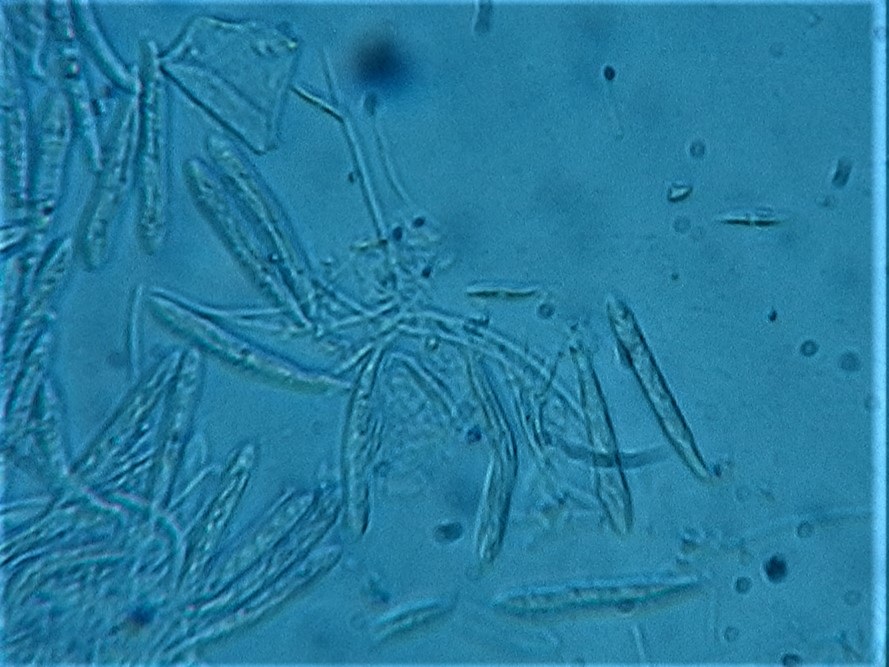 Incrucipulum ciliare image