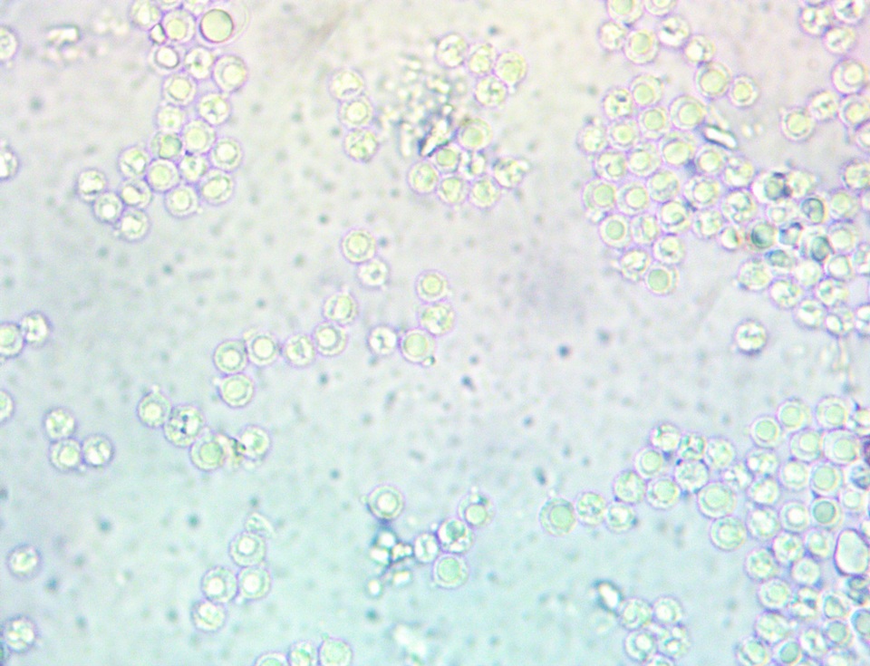 Limacella illinita var. rubescens image