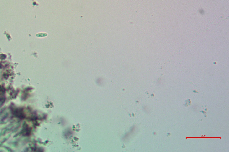 Micarea misella image