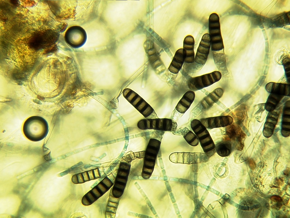 Thielaviopsis basicola image