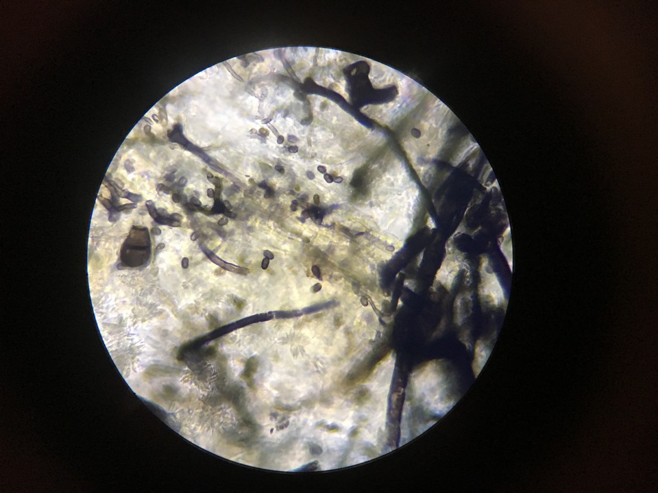 Resinicium image