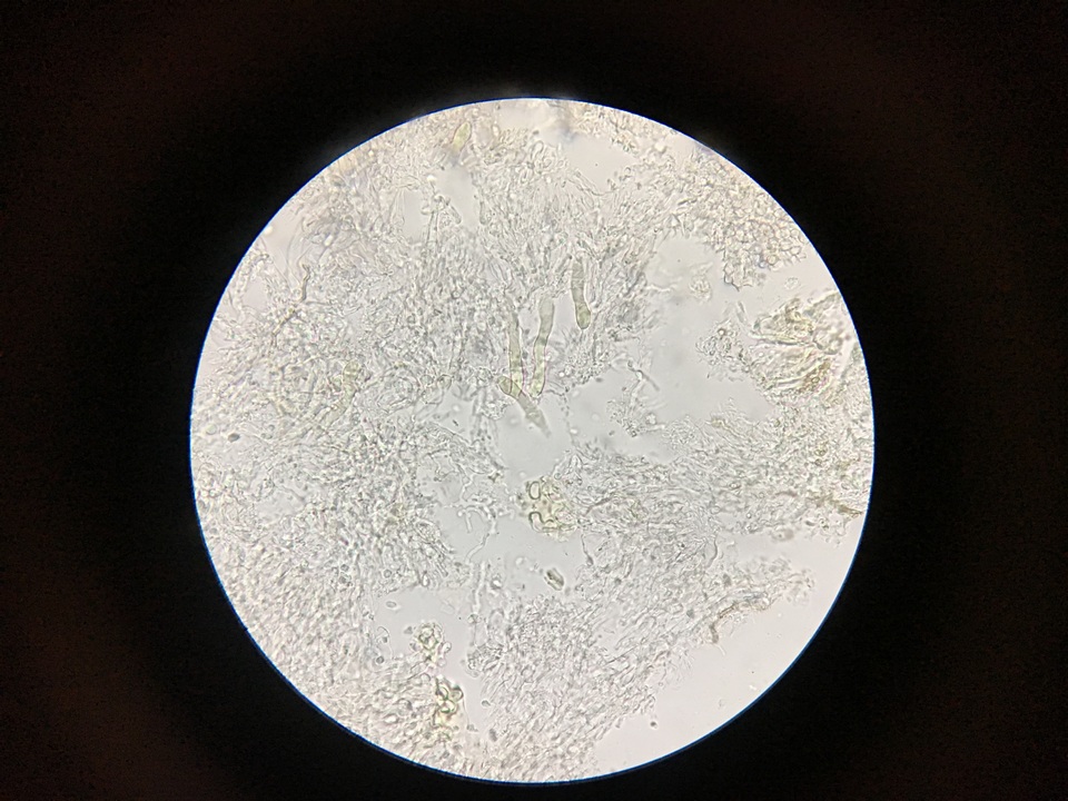 Hyphoderma tenue image