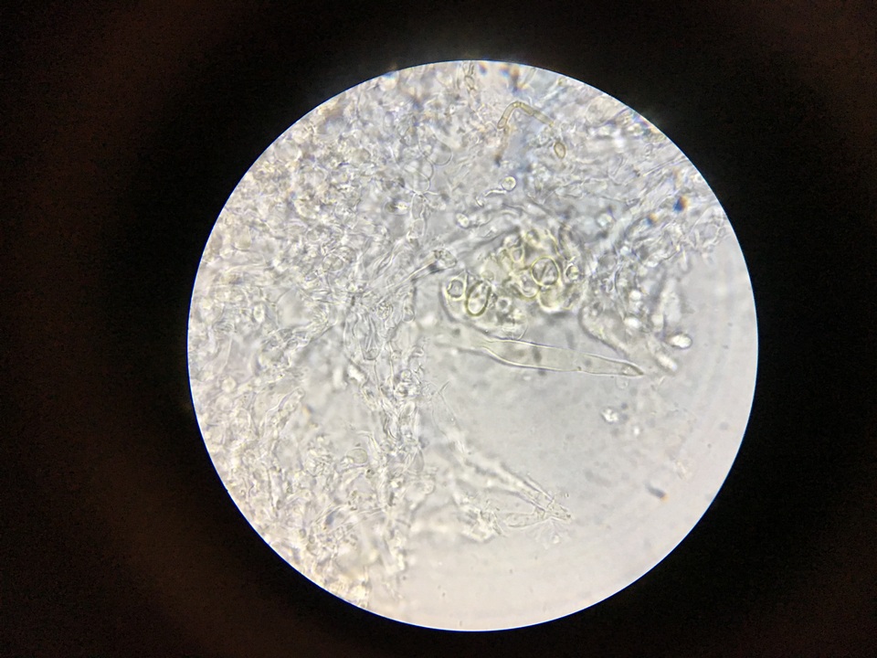 Hyphoderma tenue image