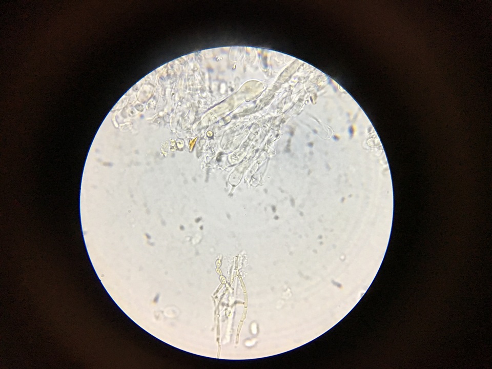 Hyphoderma tenue image