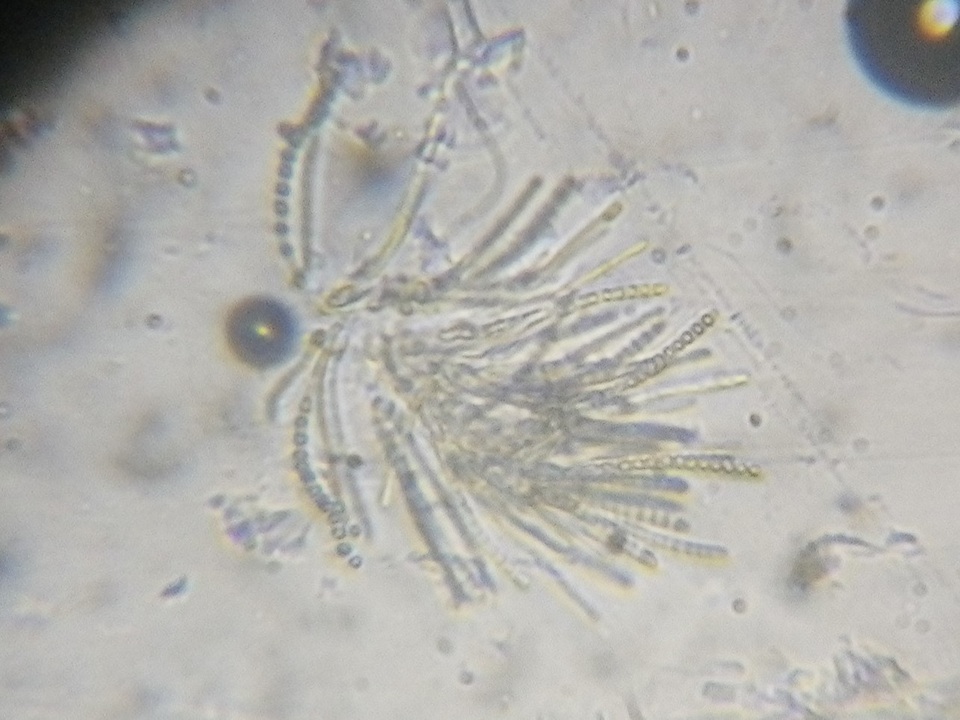 Trichoderma aureoviride image