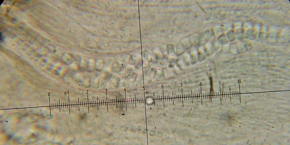 Stictis urceolata image