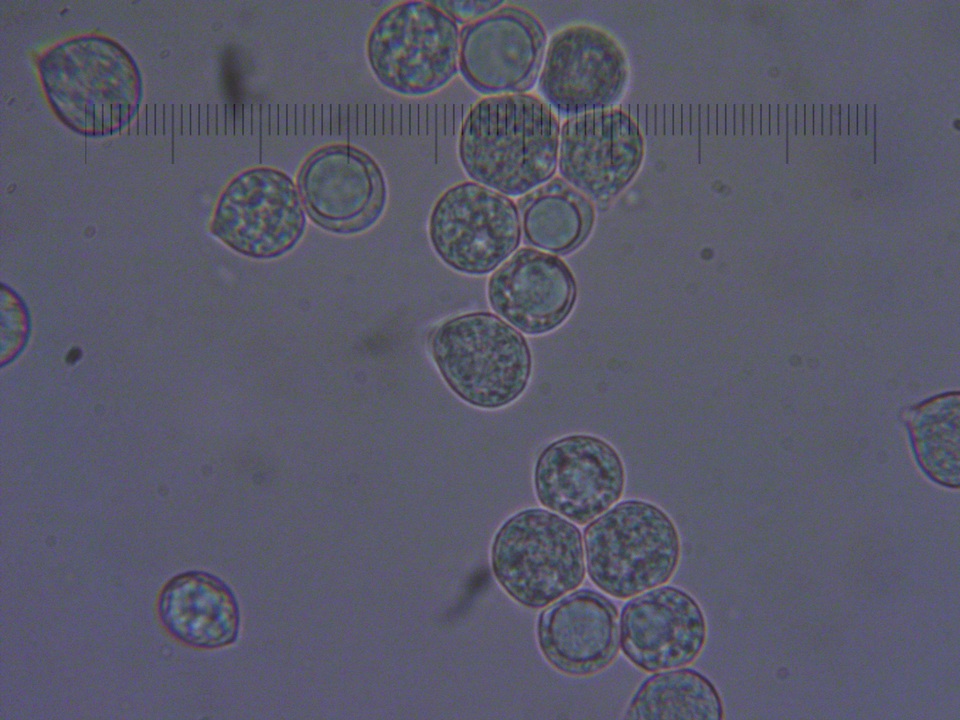 Amanita crassiputamen image