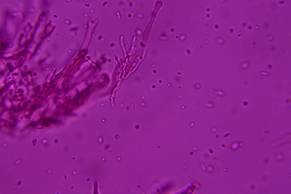 Syzygospora effibulata image