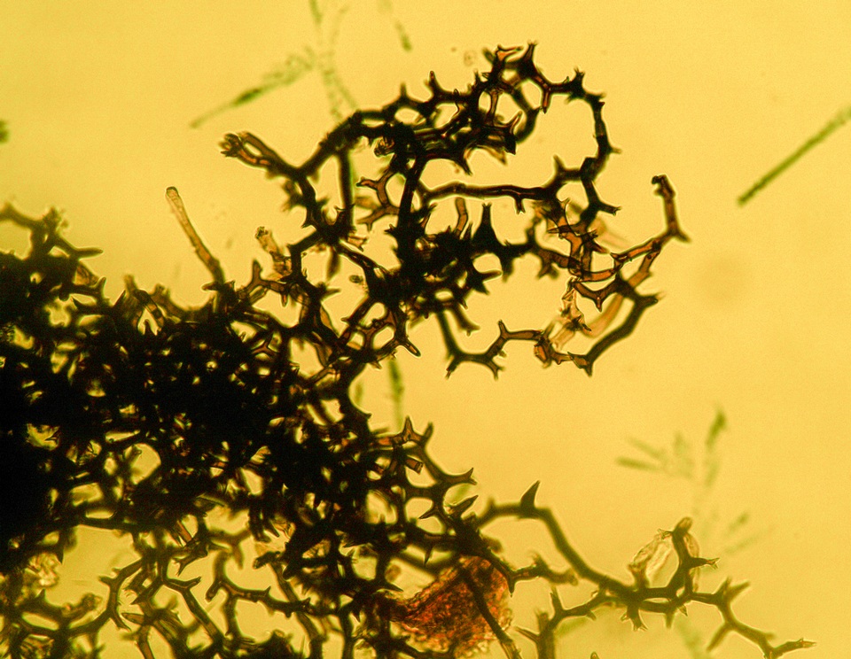 Nitschkia acanthostroma image
