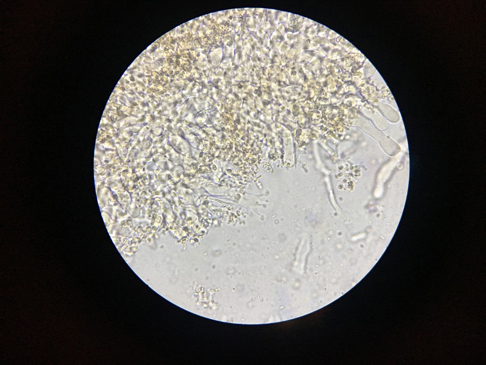 Corticium lombardiae image