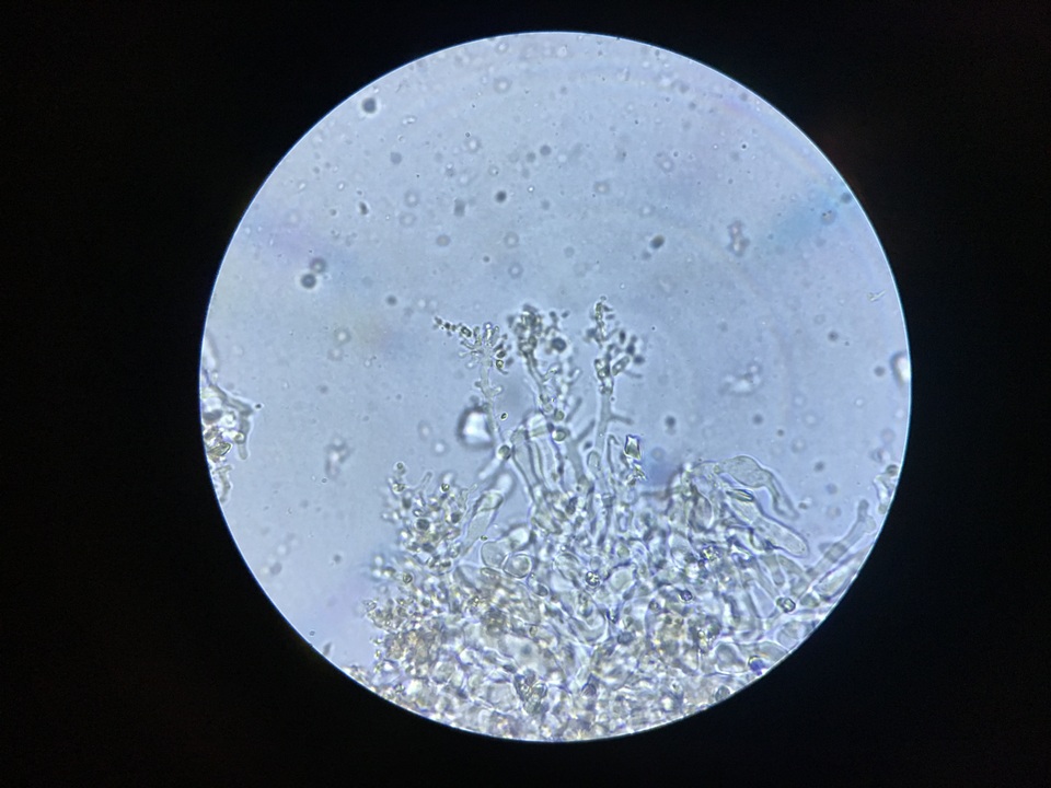 Corticium lombardiae image