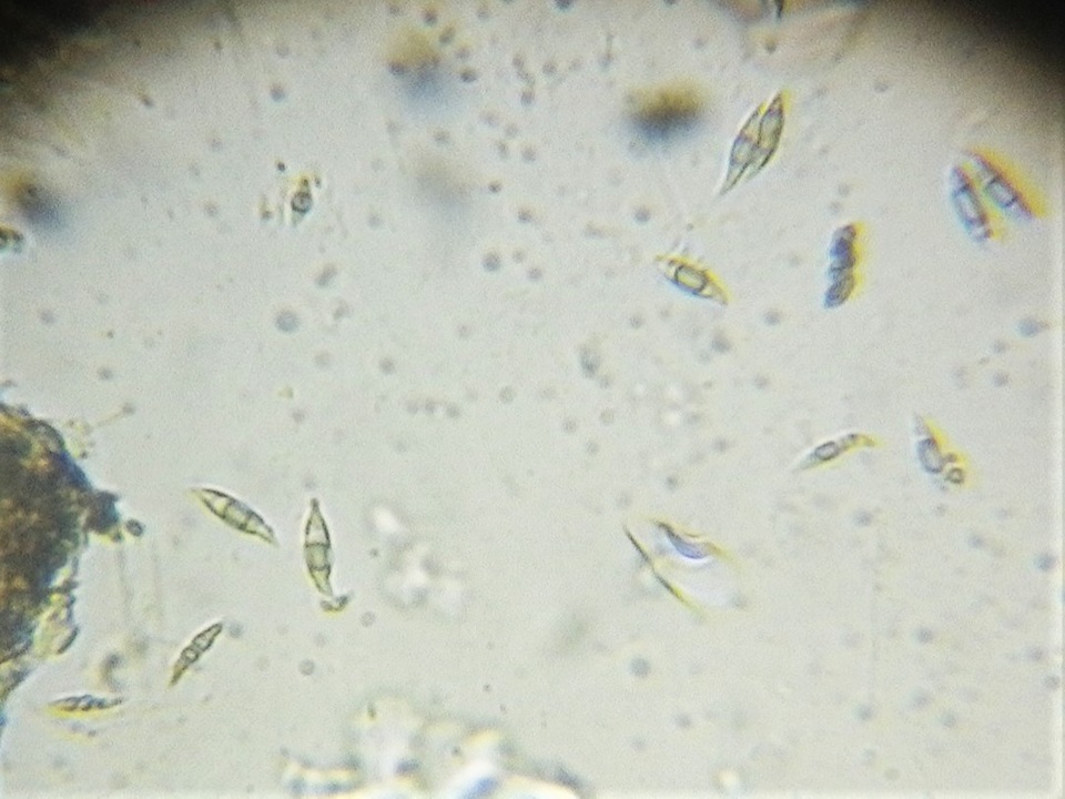 Anthostomella rubicola image