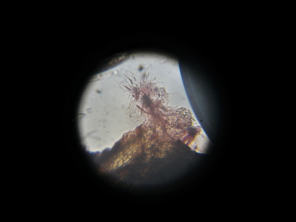 Anthostomella rubicola image