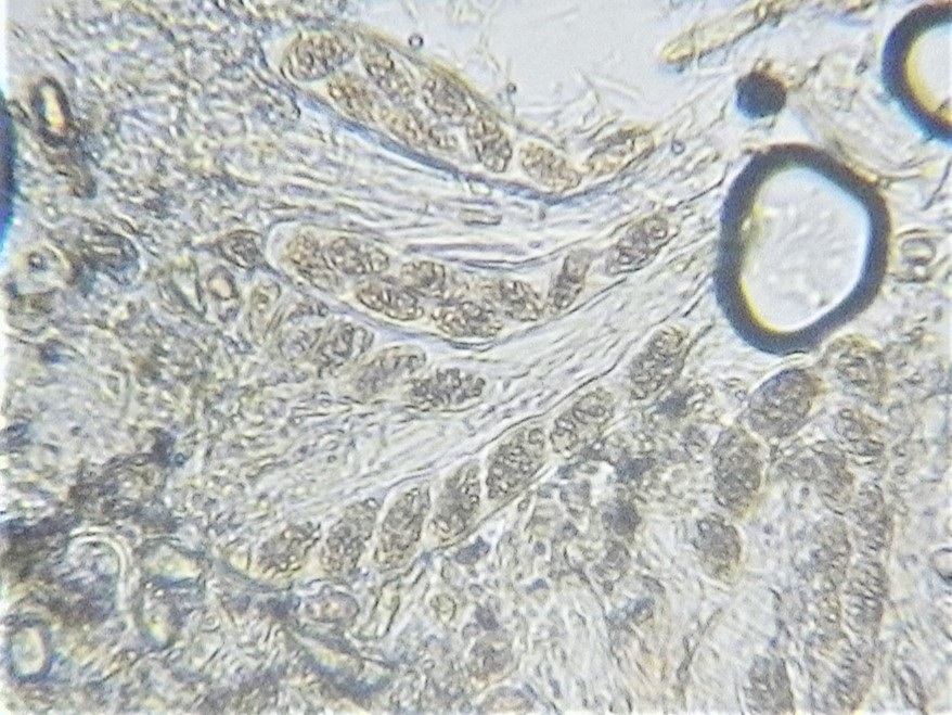Trapelia glebulosa image