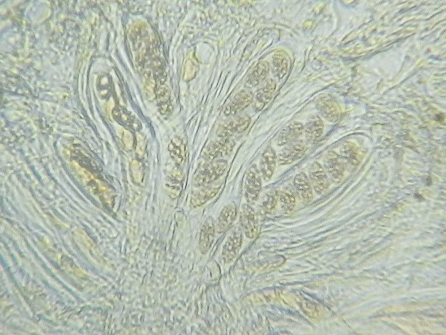 Trapelia glebulosa image